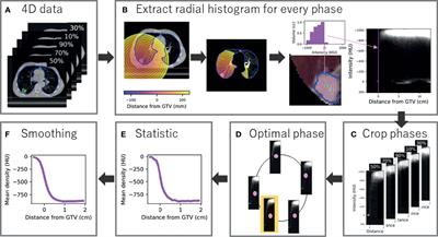 Radial Data Mining to Identify Density–Dose Interactions That Predict Distant Failure Following SABR